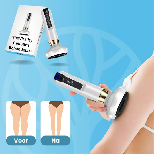 SheVitality Cellulitis Behandelaar – Eenvoudig, Veilig en Effectief